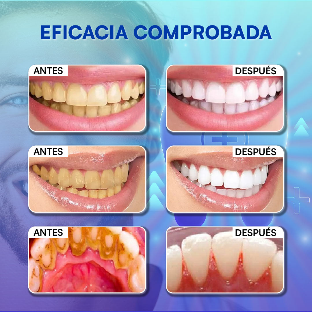 1+1 GRATIS | PearlWhite® - Dientes Blancos Hasta 5 Tonos al Instante