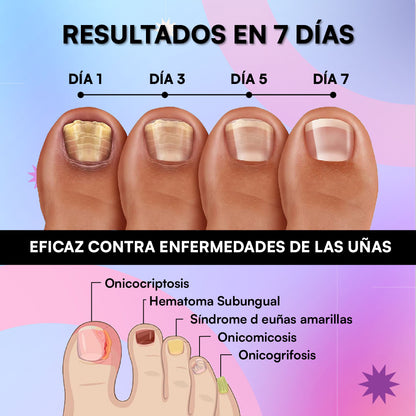 1+2 GRATIS | PowerNail® - Fortalece tus Uñas en 7 días